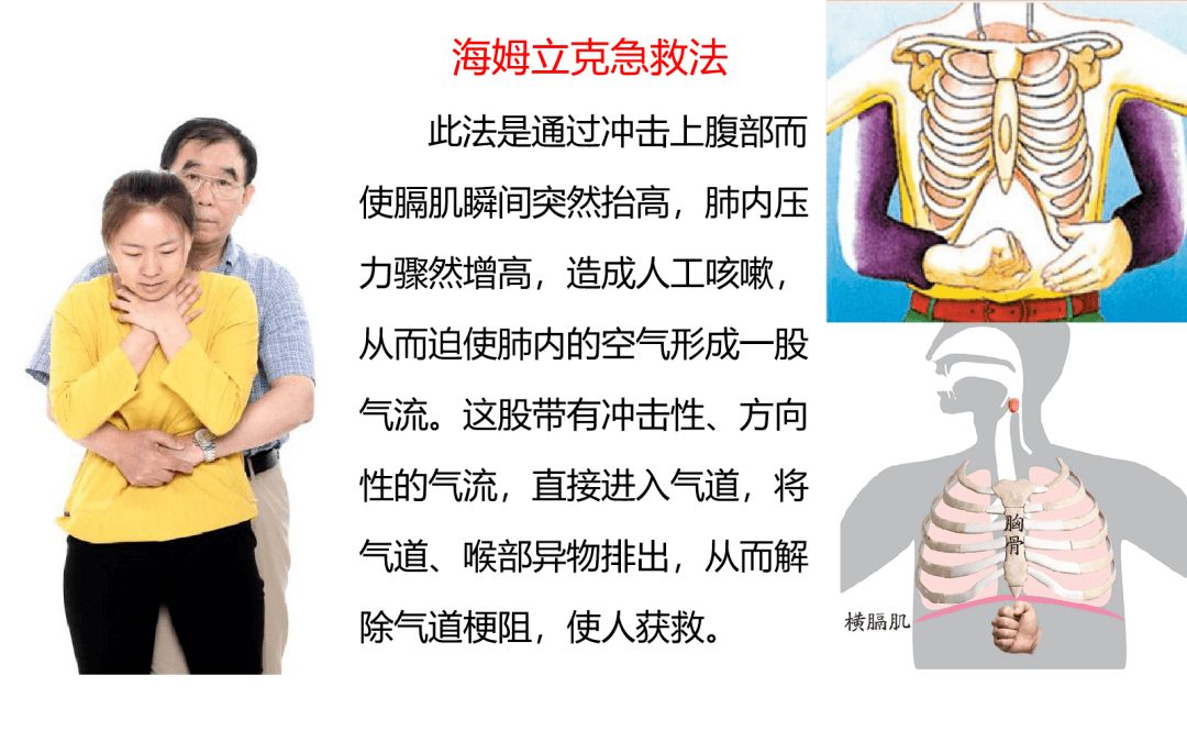 海姆克急救法，每个家长都应该学会的急救方法！