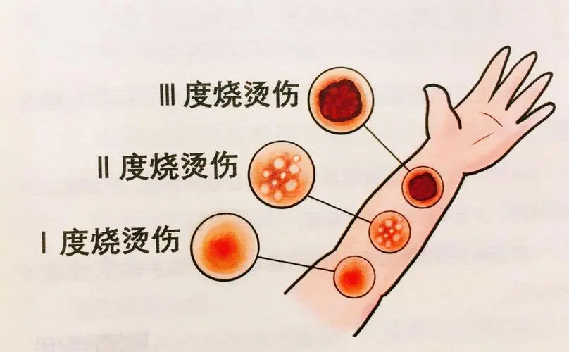 面对火灾，应该如何自救？