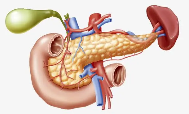 胰腺癌为什么一发现就是晚期